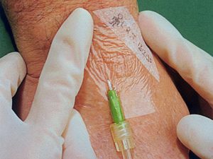 Medicazione 3M TEGADERM™ - 6 x 7 cm. - sterile - Cf. 100 pz. - immagine 3