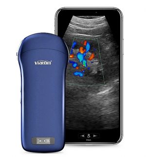 Ecografo portatile WIRELESS VIATOM 3 IN 1 - LINEARE/CONVESSO/CARDIACO - immagine 3