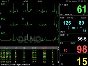 MONITOR MULTIPARAMETRICO PC-3000 - immagine 4