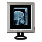 TORINOMED - NEGATIVOSCOPIO ULTRAPIATTO DA TAVOLO LED - 42x36 cm.